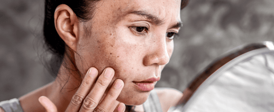 How to Stop Skin Picking ADHD?